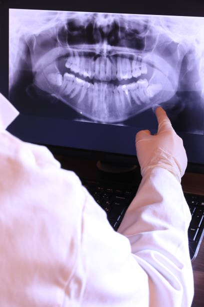 Best Emergency Gum Treatment in Jackson, MI
